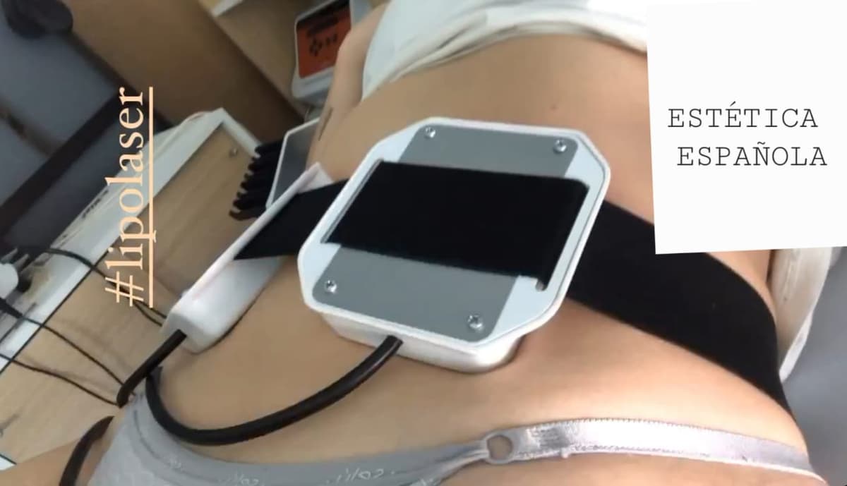 Lipolaser — Estética Española
